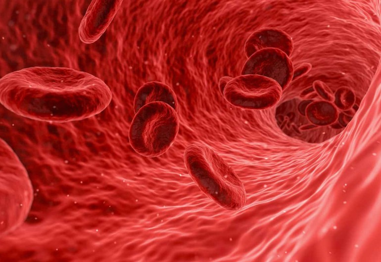 Iron deficiency anemia